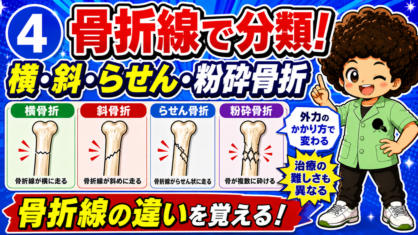 横・斜・らせん・粉砕骨折の骨折線の違い